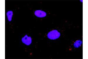 Proximity Ligation Analysis of protein-protein interactions between MAPK11 and MAP3K7IP1.