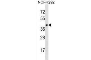 Western Blotting (WB) image for anti-V-Set and Immunoglobulin Domain-Containing Protein 4 (VSIG4) antibody (ABIN3000551) (VSIG4 抗体)