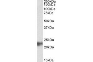 Image no. 1 for anti-Transgelin (TAGLN) (C-Term) antibody (ABIN374407) (Transgelin 抗体  (C-Term))