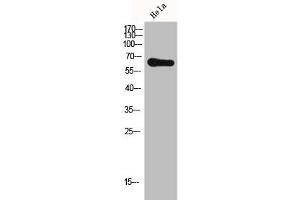 Western Blot analysis of HELA cells using Frizzled-7 Polyclonal Antibody (FZD7 抗体  (N-Term))