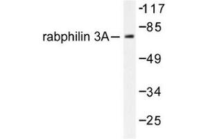 Image no. 1 for anti-Rabphilin 3A (RPH3A) antibody (ABIN272075) (RPH3A 抗体)