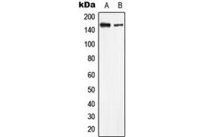 Western blot analysis of LMTK2 expression in HeLa (A), HEK293T (B) whole cell lysates. (LMTK2 抗体  (Center))