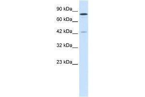 WB Suggested Anti-JMJD1A Antibody Titration:  1. (KDM3A 抗体  (C-Term))