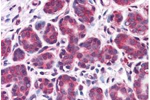 Human Breast: Formalin-Fixed, Paraffin-Embedded (FFPE) (Retinoblastoma Binding Protein 8 抗体  (AA 452-747))