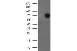 Western Blotting (WB) image for anti-ALX Homeobox 4 (ALX4) antibody (ABIN1496621) (ALX4 抗体)