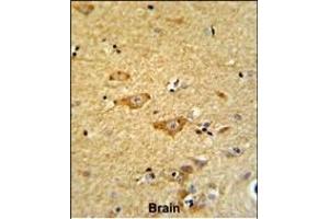 Formalin-fixed and paraffin-embedded human brain reacted with OMD Antibody (Center), which was peroxidase-conjugated to the secondary antibody, followed by DAB staining. (Osteomodulin 抗体  (AA 234-263))