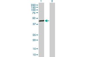 Western Blot analysis of TMEM171 expression in transfected 293T cell line by TMEM171 MaxPab polyclonal antibody. (TMEM171 抗体  (AA 1-323))