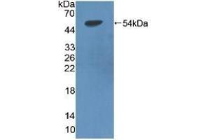 Detection of Recombinant LIPD, Rat using Polyclonal Antibody to Lipoprotein lipase (LPL) (Lipoprotein Lipase 抗体  (AA 28-474))