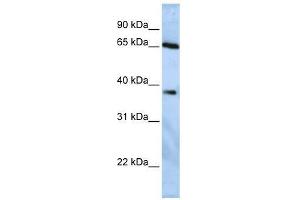 USP3 antibody used at 1. (USP3 抗体  (Middle Region))