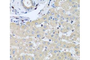 Immunohistochemistry (Paraffin-embedded Sections) (IHC (p)) image for anti-Coactosin-Like Protein antibody (ABIN7261090)