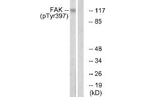 Immunohistochemistry analysis of paraffin-embedded human brain tissue using FAK (Phospho-Tyr397) antibody. (FAK 抗体  (pTyr397))