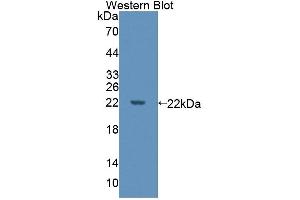 Detection of Recombinant DPPA3, Human using Polyclonal Antibody to Developmental Pluripotency Associated Protein 3 (DPPA3) (DPPA3 抗体  (AA 1-159))