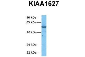 Host:  Rabbit  Target Name:  KIAA1627  Sample Tissue:  Human PANC1  Antibody Dilution:  1. (KIAA1627 抗体  (N-Term))