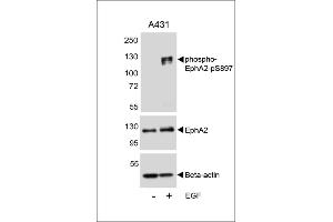 Western blot analysis of lysates from A431 cell line, untreated or treated with EGF, 100 ng/mL, using phospho-EphA2-p A (upper), EphA2 (middle) or Beta-actin (lower). (EPH Receptor A2 抗体  (pSer897))