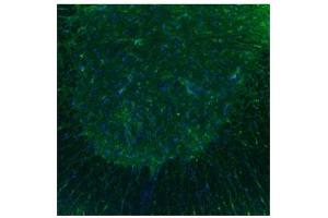 Sample Type :  Spinal Cord, ventral horns (Serotonin Receptor 3B 抗体  (N-Term))