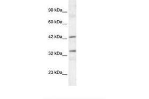 Image no. 2 for anti-TATA Box Binding Protein (TBP)-Associated Factor, RNA Polymerase I, A, 48kDa (TAF1A) (C-Term) antibody (ABIN6735836) (TAF1A 抗体  (C-Term))
