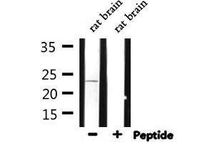 Western blot analysis of extracts from rat brain, using ARF4 Antibody. (ARF4 抗体  (Internal Region))