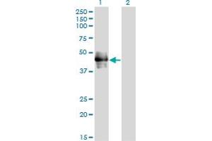 Western Blot analysis of CD177 expression in transfected 293T cell line by CD177 monoclonal antibody (M01), clone 4C4. (CD177 抗体  (AA 21-120))