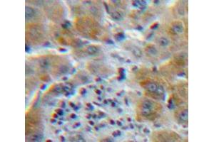 IHC-P analysis of Liver tissue, with DAB staining. (CSF3R 抗体  (AA 26-138))