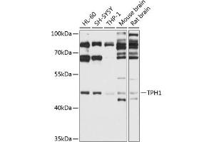 Western blot analysis of extracts of various cell lines, using TPH1 antibody (ABIN3022154, ABIN3022155, ABIN3022156 and ABIN6218634) at 1:1000 dilution. (Tryptophan Hydroxylase 1 抗体  (AA 345-444))