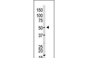 Antibody is used in Western blot to detect GDF9 in HL60 cell lysate. (GDF9 抗体  (N-Term))