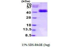 SDS-PAGE (SDS) image for Renin (REN) (AA 24-406) protein (His tag) (ABIN6387862)
