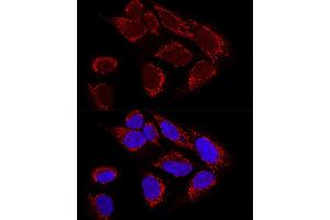 Confocal immunofluorescence analysis of U2OS cells using MTX2 Polyclonal Antibody (ABIN6129694, ABIN6144192, ABIN6144193 and ABIN6223964) at dilution of 1:100. (MTX2 抗体  (AA 1-263))