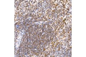 Immunohistochemistry of paraffin-embedded mouse spleen using TCE Rabbit mAb (ABIN7270877) at dilution of 1:25 (40x lens).