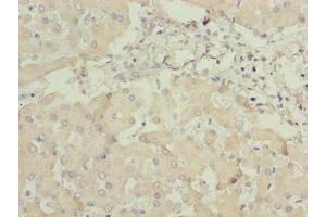 Immunohistochemistry of paraffin-embedded human liver tissue using ABIN7144243 at dilution of 1:100 (ANKRA2 抗体  (AA 1-313))