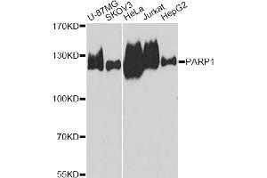 Western blot analysis of extracts of various cell lines, using PARP1 antibody (ABIN5975769) at 1/1000 dilution. (PARP1 抗体)