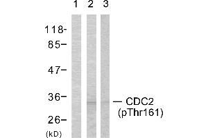 Western blot analysis using CDC2 (Phospho-Thr161) Antibody: Lin: The extracts from COLO cells using preincubated with synthesized phosphopeptide; Lin: The extracts from COLO cells. (CDK1 抗体  (pThr161))