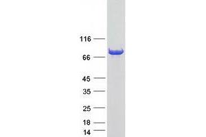 Validation with Western Blot
