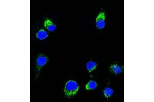 Confocal Immunofluorescent analysis of Ramos cells using AF488-labeled Lambda Light Chain Monoclonal Antibody (HP6054) (Green). (IgL 抗体)