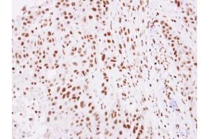 IHC-P Image Immunohistochemical analysis of paraffin-embedded SCC4 xenograft, using Histone H2A. (H2AFZ 抗体  (N-Term))