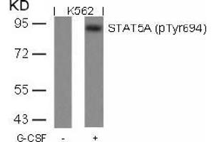 Image no. 1 for anti-Signal Transducer and Activator of Transcription 5A (STAT5A) (pTyr694) antibody (ABIN196696) (STAT5A 抗体  (pTyr694))