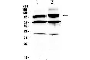 Western blot analysis of HCN2 using anti- HCN2 antibody . (HCN2 抗体  (C-Term))