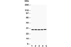 Western blot testing of CD40L antibody and Lane 1:  MCF-7 (CD40 Ligand 抗体  (N-Term))
