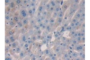 Detection of IL2 in Mouse Liver Tissue using Polyclonal Antibody to Interleukin 2 (IL2) (IL-2 抗体  (AA 10-169))