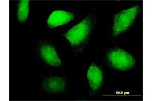 Immunofluorescence of purified MaxPab antibody to FLT3LG on HeLa cell. (FLT3LG 抗体  (AA 1-235))