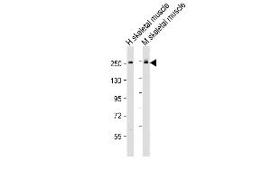 All lanes : Anti-MYH6 Antibody (Center) at 1:2000 dilution Lane 1: human skeletal muscle lysate Lane 2: mouse skeletal muscle lysate Lysates/proteins at 20 μg per lane. (MYH6 抗体  (AA 833-867))