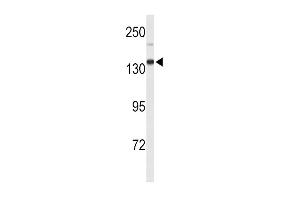 Western blot analysis of XDH Antibody (N-term) (ABIN653225 and ABIN2842759) in mouse lung tissue lysates (35 μg/lane). (XDH 抗体  (N-Term))