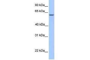 WB Suggested Anti-MTL5 Antibody Titration: 0. (MTL5 抗体  (N-Term))
