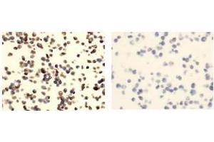 Immunohistochemistry (IHC) image for anti-Tumor Necrosis Factor Receptor Superfamily, Member 13C (TNFRSF13C) antibody (ABIN1449226) (TNFRSF13C 抗体)