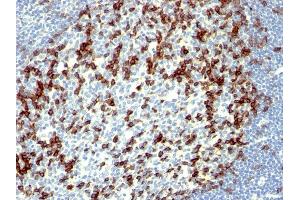 Formalin-fixed, paraffin-embedded human Tonsil stained with PD1 (CD279) Monoclonal Antibody (NAT105). (PD-1 抗体)