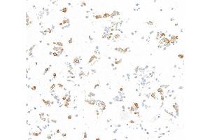 Immunocytochemistry (ICC) image for anti-Nuclear Factor-kB p65 (NFkBP65) (C-Term) antibody (ABIN7795800)