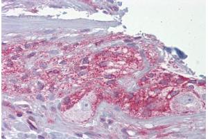 Anti-NCS-1 antibody IHC staining of human small intestine, myenteric plexus. (NCS1 抗体  (C-Term))