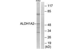 Western blot analysis of extracts from K562 cells, using ALDH1A2 Antibody. (ALDH1A2 抗体  (AA 412-461))