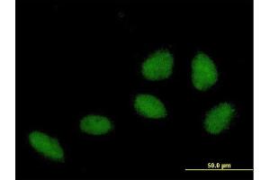Immunofluorescence of purified MaxPab antibody to ZNF549 on HeLa cell. (ZNF549 抗体  (AA 1-640))