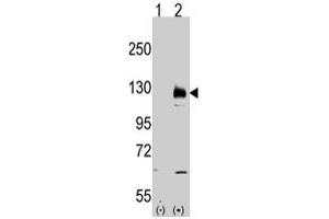 Western blot analysis of TRPM8 (arrow) using rabbit TRPM8 polyclonal antibody . (TRPM8 抗体  (AA 933-963))