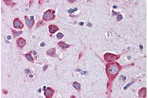 Human Brain, Cortex: Formalin-Fixed, Paraffin-Embedded (FFPE) (Serotonin Receptor 1A 抗体)